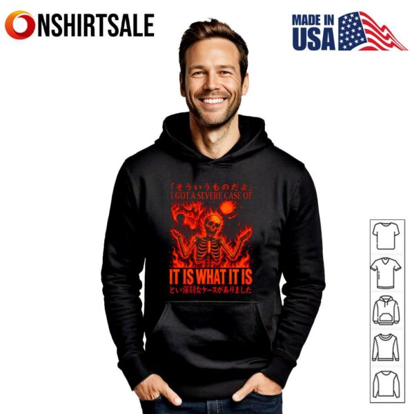 Skeleton I Got A Severe Case of It is What It is T-Shirt